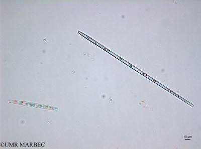 phyto/Brazilian_Amazon_coast/Amazomix_station_22/AMAZOMIX September 2021/Thalassionema sp3 cf nitzschioides et Thalassionema sp5 cf frauenfeldii (St22_thalassionam_synedra220912_001_ovl-5).tif(copy)_thumb.jpg